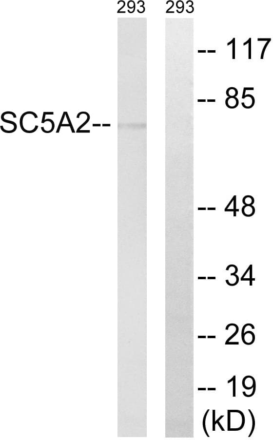 SLC5A2 / SGLT2 Antibody (aa101-150)