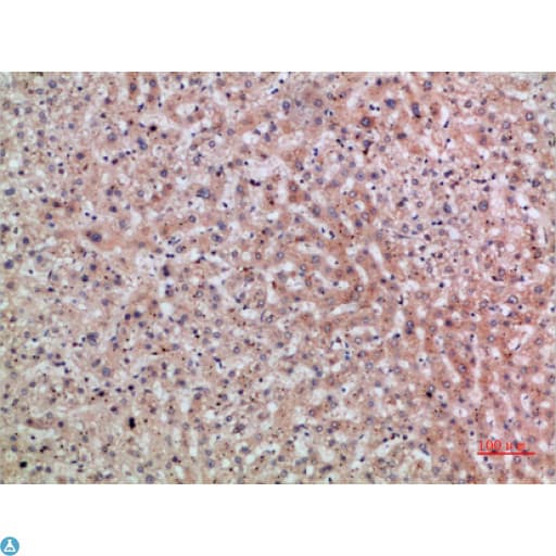 ERLIN1 / SPFH1 Antibody