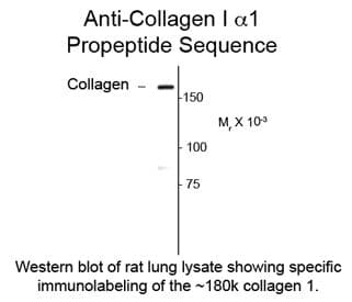 COL1A1 / Collagen I Alpha 1 Antibody