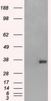 CD32A Antibody (clone OTI9C6, Carrier-free)