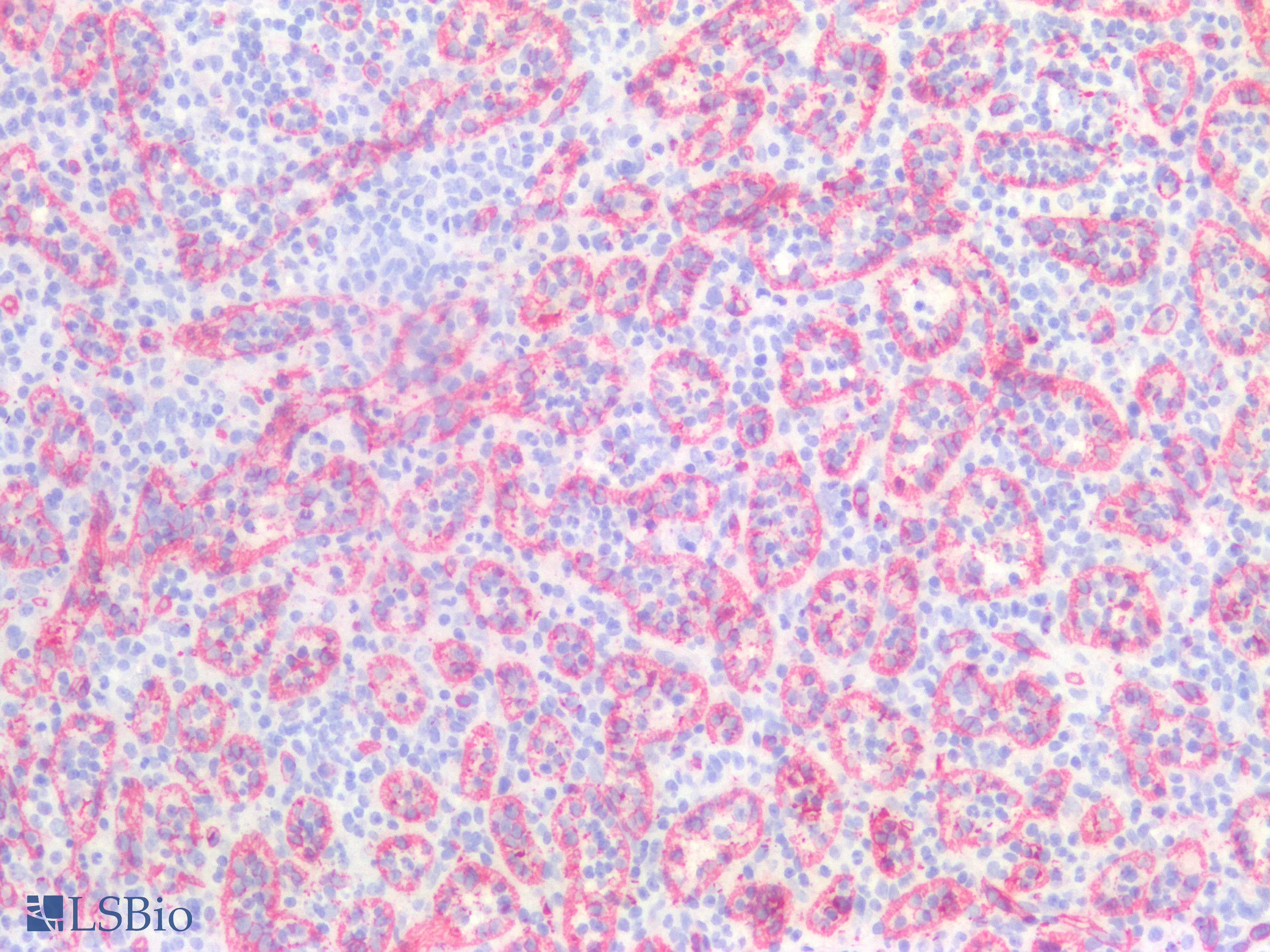 IHC-plus™ Blood Group A Antibody (clone HE-193, Supernatant)