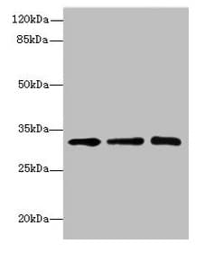 Polyclonal Rabbit anti-Human SGCD / Delta-Sarcoglycan Antibody (IHC, WB)