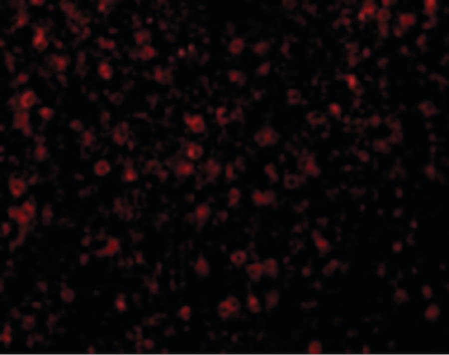 Polyclonal Rabbit anti-Human CCR3 Antibody (IHC, IF, WB)