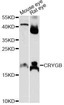 CRYGB Antibody