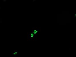 IHC-plus™ GLB1 / Beta-Galactosidase Antibody (clone 5H2)