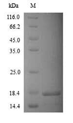 Human KCNK2 / TREK-1 Protein (Recombinant 6His, N-terminus)