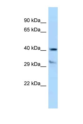 TTPA Antibody (aa204-253)