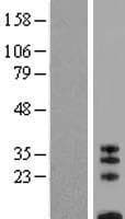 CD8B / CD8 Beta Protein (Over-Expression Lysate Myc-DDK (Flag))