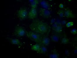 Basigin / Emmprin / CD147 Antibody (clone OTI3E5)