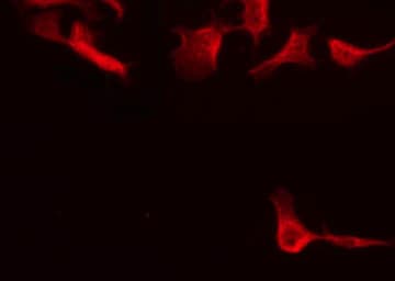 Polyclonal Rabbit anti-Human USP30 Antibody (IF, WB)