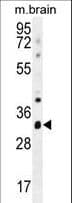 CYC1 / Cytochrome C-1 Antibody (aa263-291)