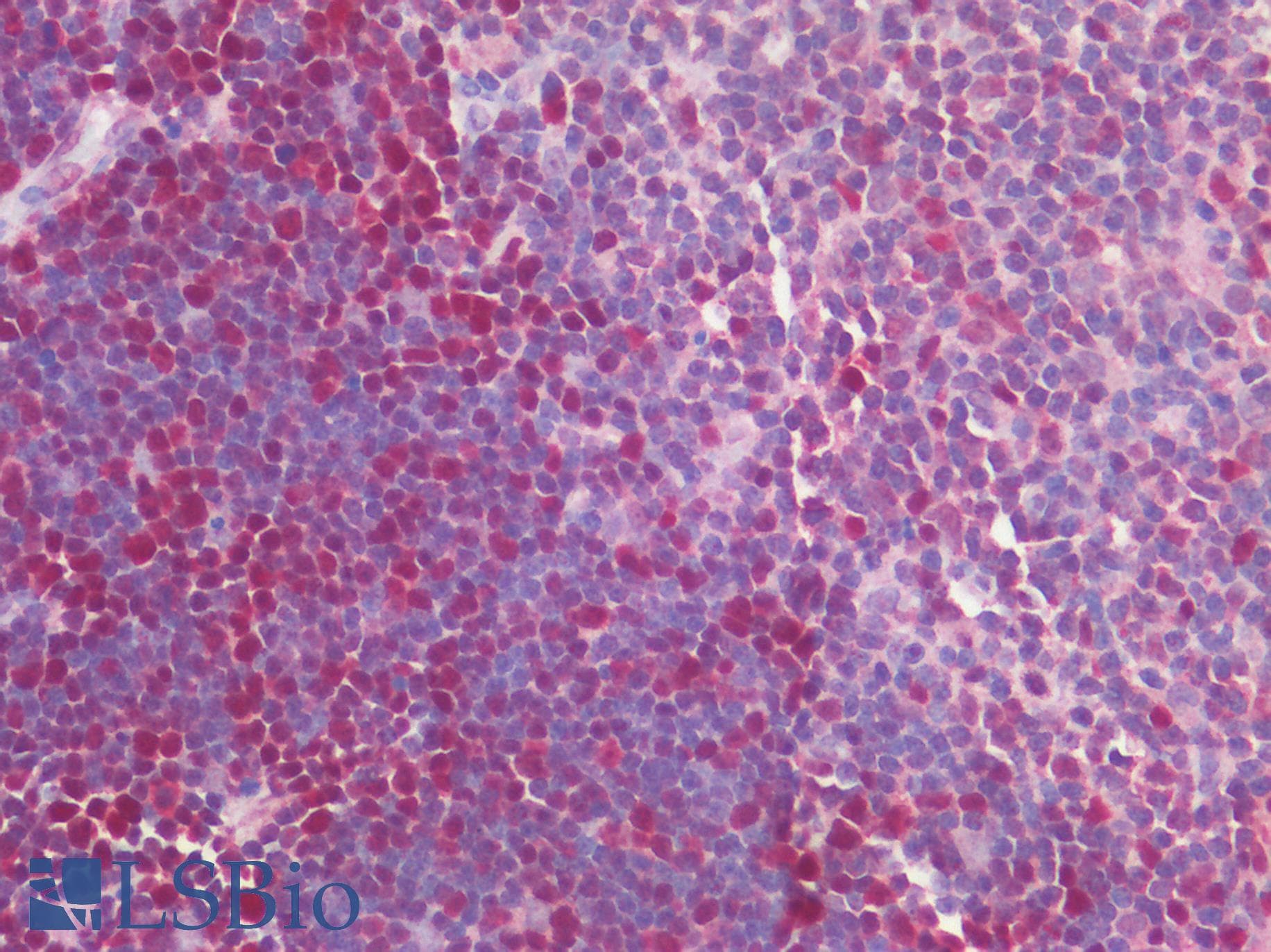 IHC-plus™ MCM4 Antibody (aa325-375)