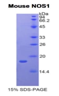 Mouse NOS1 / nNOS Protein (Recombinant His)