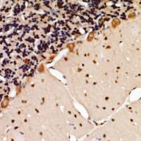 TSG101 Antibody