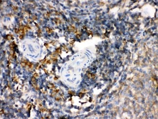 TGM2 / Transglutaminase 2 Antibody