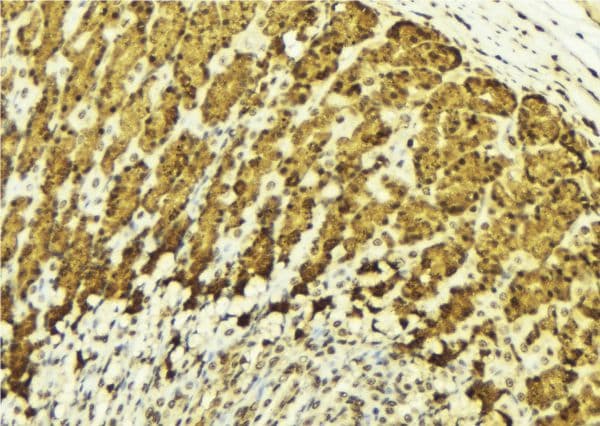 CHUK / IKKA / IKK Alpha Antibody