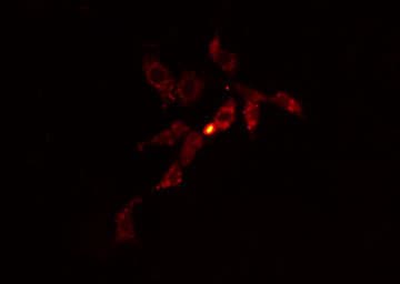 Polyclonal Rabbit anti-Human GIT1 Antibody (IHC, IF, WB)