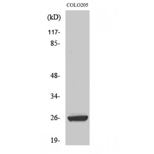 HMG2 / HMGB2 Antibody (100-180 aa, Internal)
