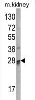 COMTD1 Antibody (aa218-246)