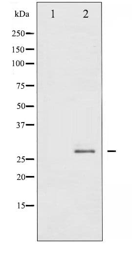 HSPB1 / HSP27 Antibody (phospho-Ser78)