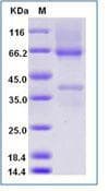 Human GPC3 / Glypican 3 Protein (Recombinant His,C-terminus)