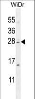 Polyclonal Rabbit anti-Human IQCF1 Antibody (aa1-30, WB)