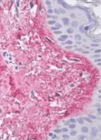 COL5A1 / Collagen V Alpha 1 Antibody (clone 13F6)