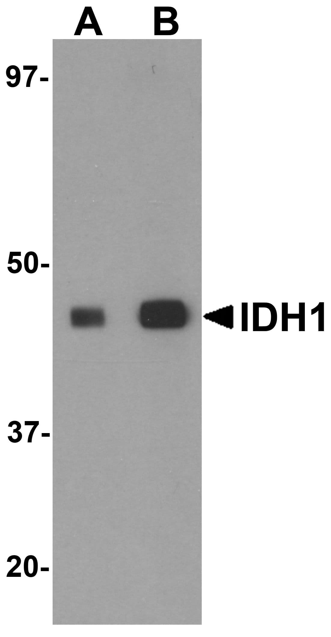 IHC-plus™ IDH1 / IDH Antibody