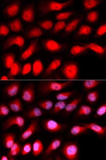 Polyclonal Rabbit anti-Human ZEB1 / AREB6 Antibody (IHC, IF, WB)