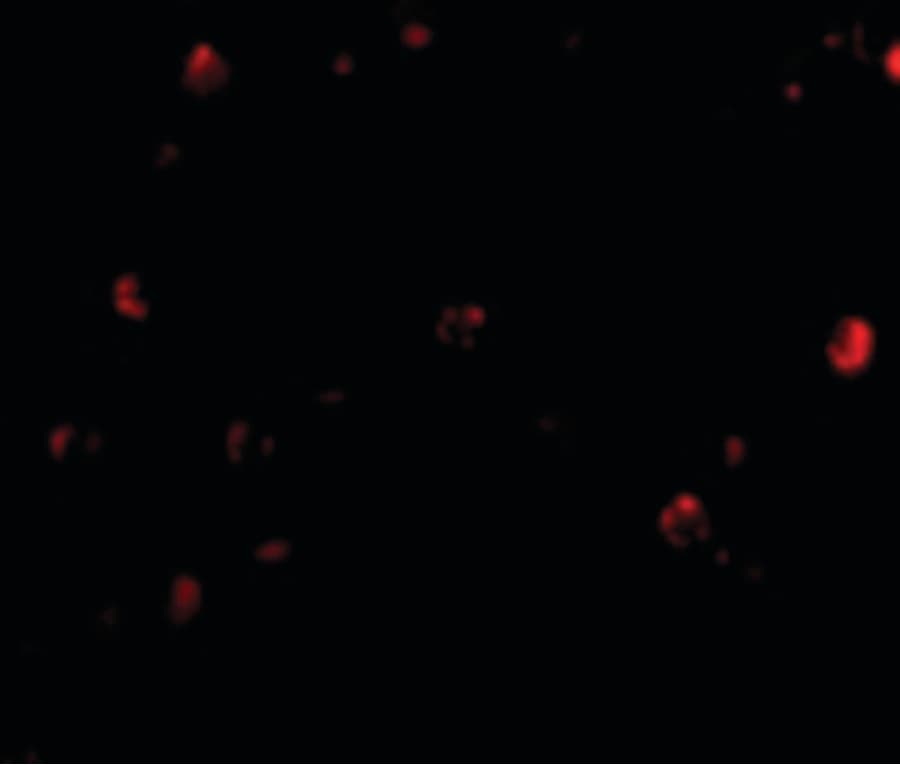 Polyclonal Rabbit anti-Human TDP-43 / TARDBP Antibody (IF, WB)
