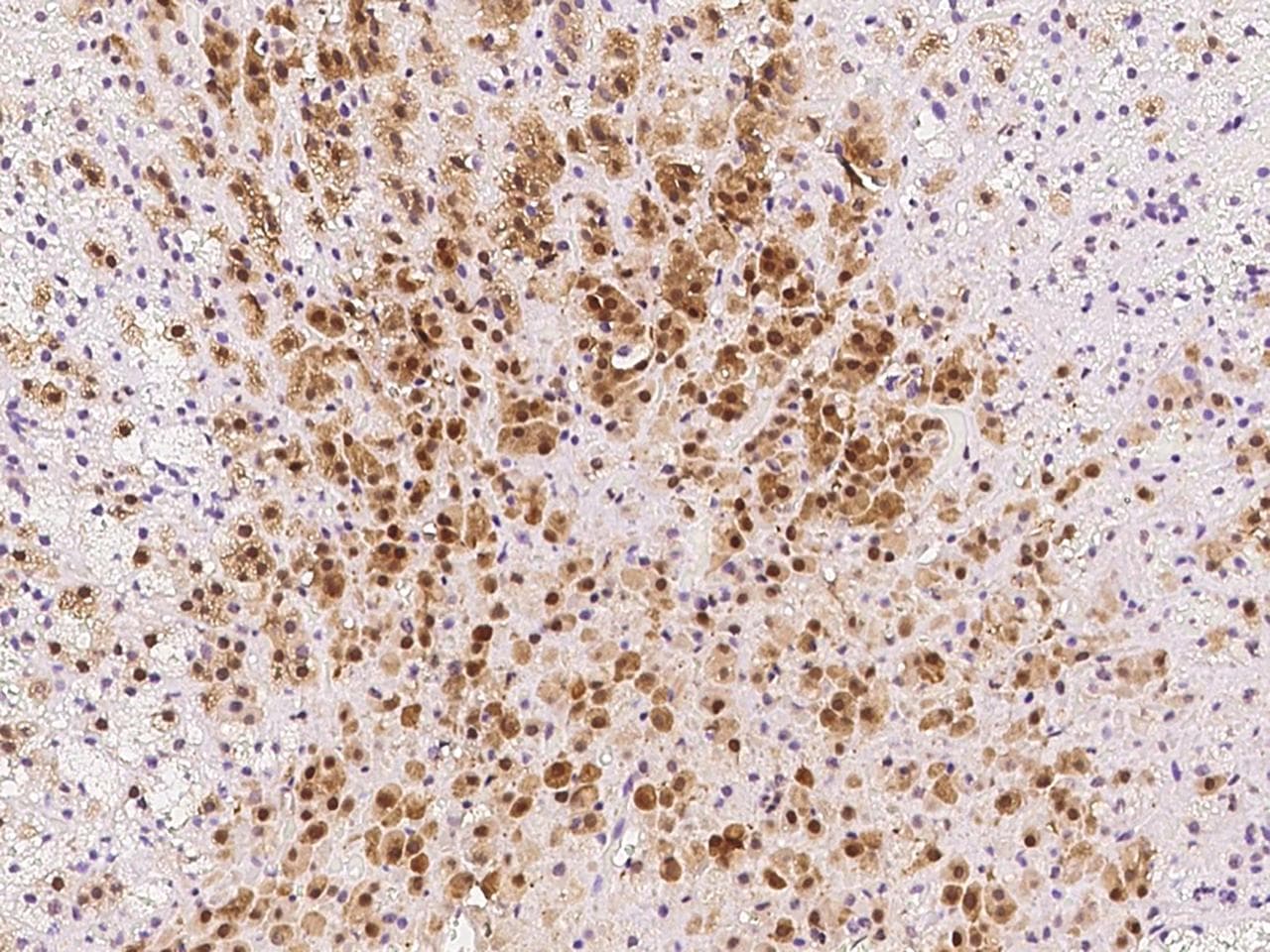 PGAM1 Antibody