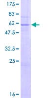 Human QPCTL Protein (Recombinant GST)