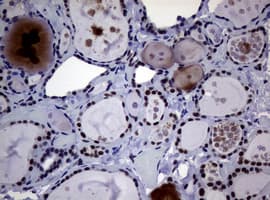 NBN / Nibrin Antibody (clone OTI9H2)