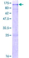 Human MYST2 / HBO1 Protein (Recombinant GST)