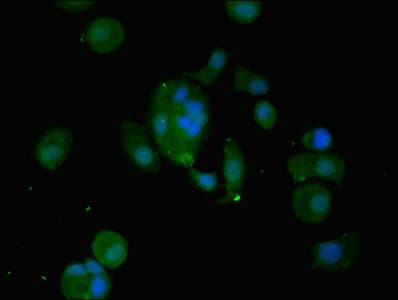 WFDC2 / HE4 Antibody