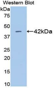 CKM / Creatine Kinase MM Antibody (aa11-367, APC)