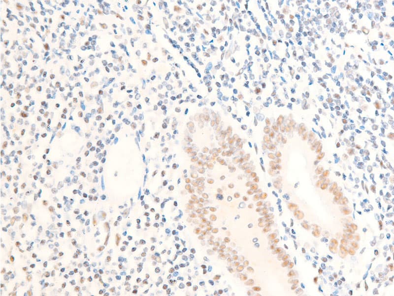Polyclonal Rabbit anti-Human MYC / c-Myc Antibody (phospho-Ser62, IHC, IF, WB)