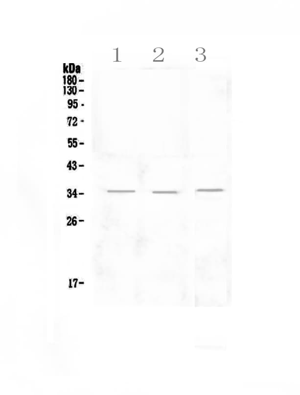 KLRK1 / CD314 / NKG2D Antibody