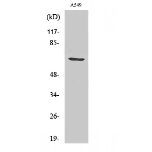 GCLC Antibody (Internal)