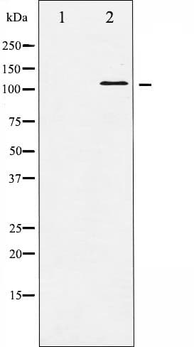 HDAC5 Antibody (phospho-Ser498)