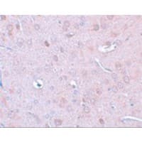 Polyclonal Rabbit anti-Human DCLK / DCLK1 Antibody (IHC, IF, WB)