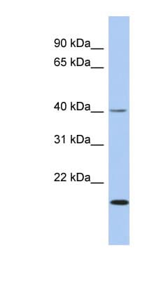 ZNF396 Antibody (aa215-264)