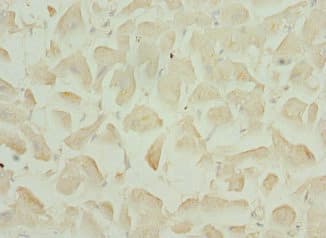 TNNI3K / CARK Antibody
