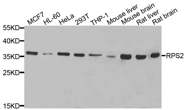 RPS2 / Ribosomal Protein S2 Antibody