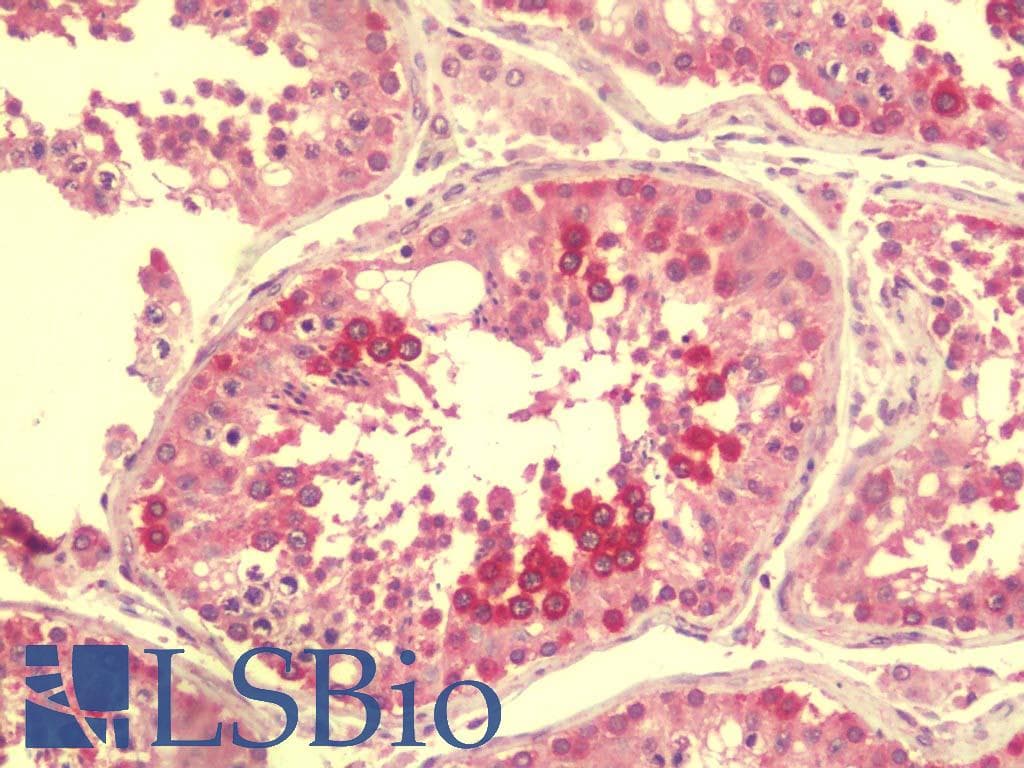 IHC-plus™ Polyclonal Rabbit anti-Human CASKIN2 Antibody (IHC, IF, WB)