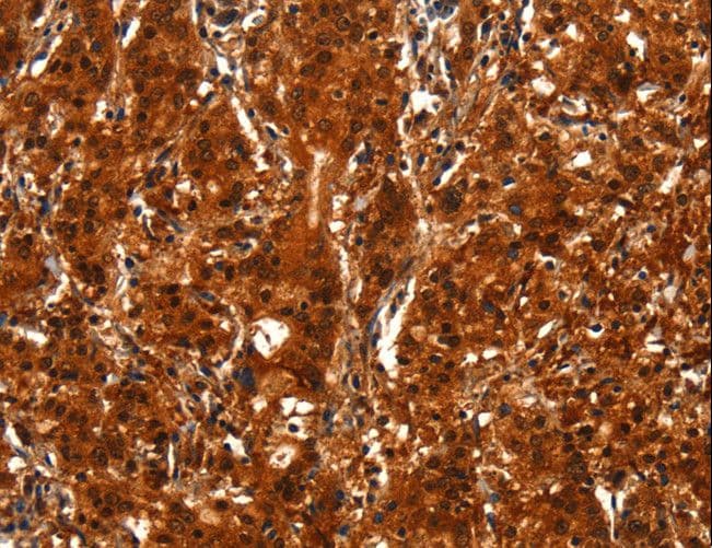 BCAS3 Antibody