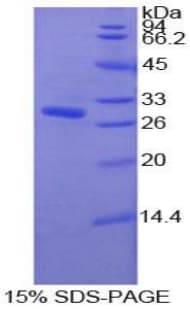 Human PDXK / PNK Protein (Recombinant His-T7)