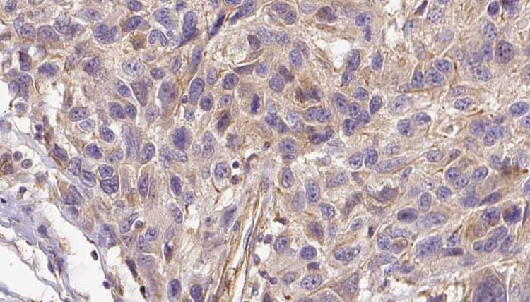 Polyclonal Rabbit anti-Human VG5Q / AGGF1 Antibody (IHC, WB)
