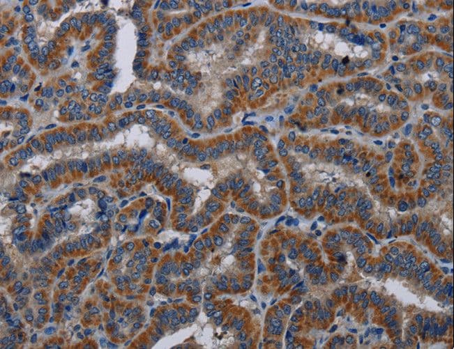Polyclonal Rabbit anti-Human KLK11 / Kallikrein 11 Antibody (IHC)