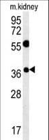 TSPAN3 Antibody (aa90-117)